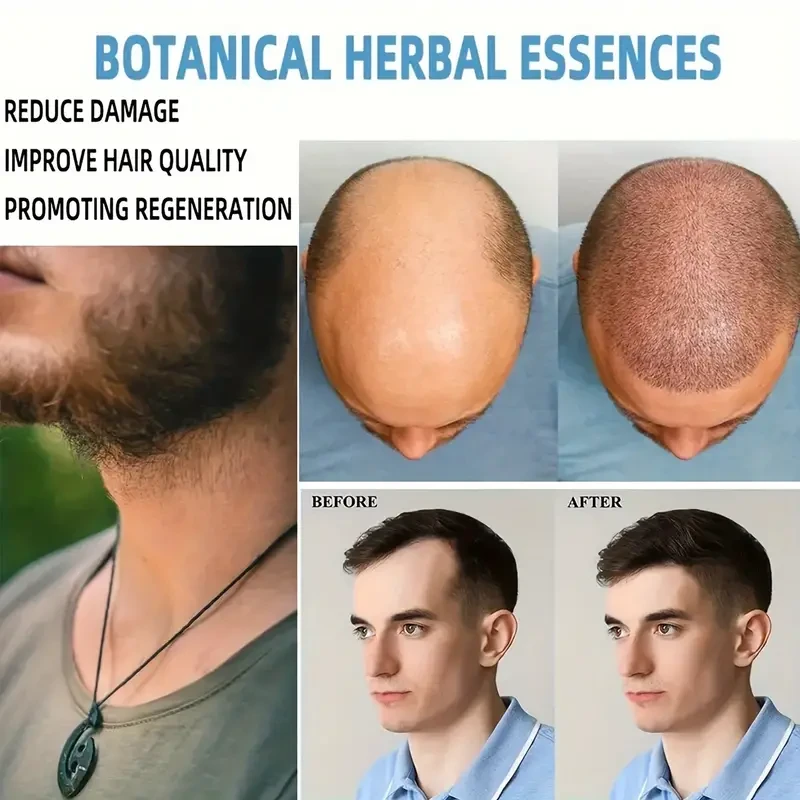 Hair Thicker Cream - Biotin & Vitamin-Enriched Hair Cream for Thicker, Longer, Fuller, Healthier Hair