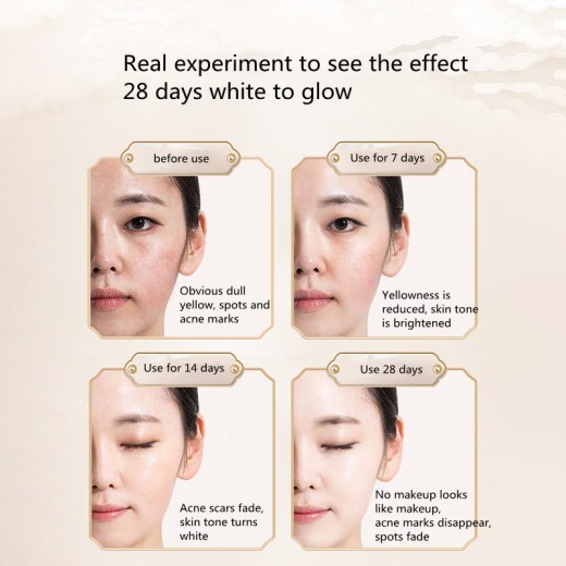 Moisturizing Moisturizing Diluted Spots Refined Pores Hydroquinone Serum