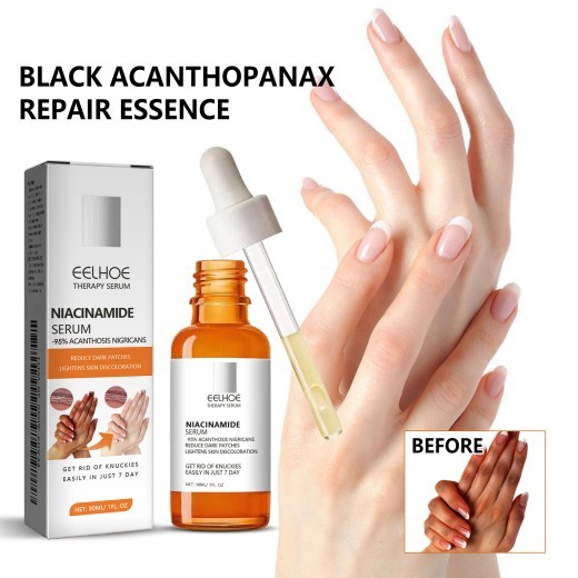 Black Ratchet Repair Joint Black Whitening Brightening