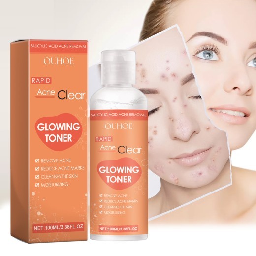 Salicylate Desalting Pimple Acne Marks Gentle And Clean