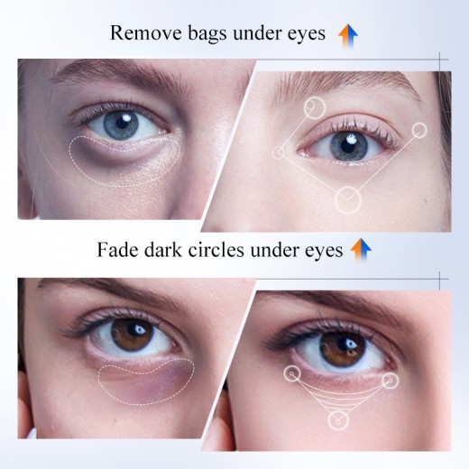 Anti-wrinkle Eye Cream Early C Late A Skin Rejuvenation Eye Cream