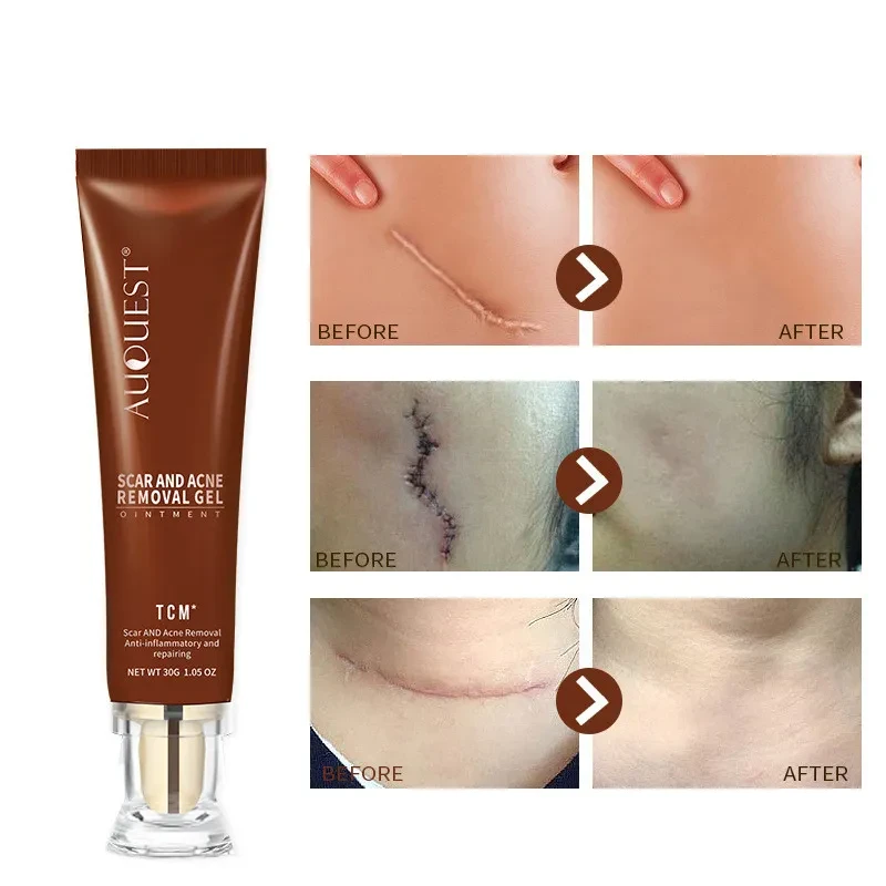 Moisturizing and Repairing Scar Skin Care Cream