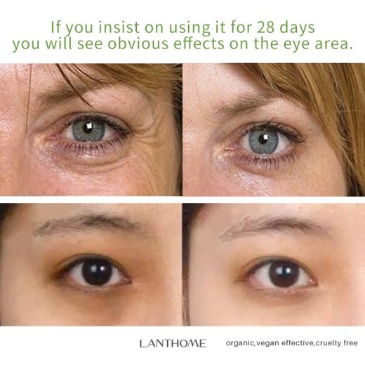 Eye Moisturizing And Fading Dark Circles