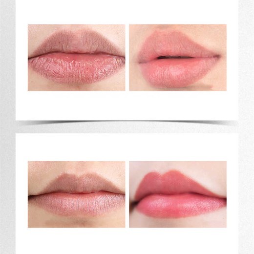 Fade Lip Lines Moisturize And Prevent Dry Cracks