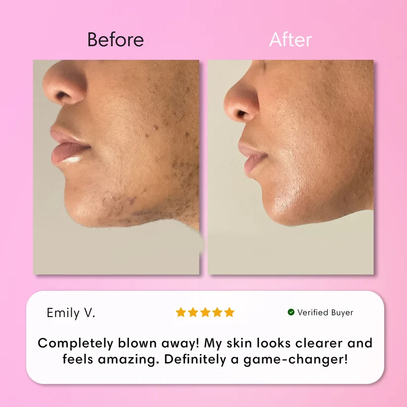 Instant Hair Removal Kit