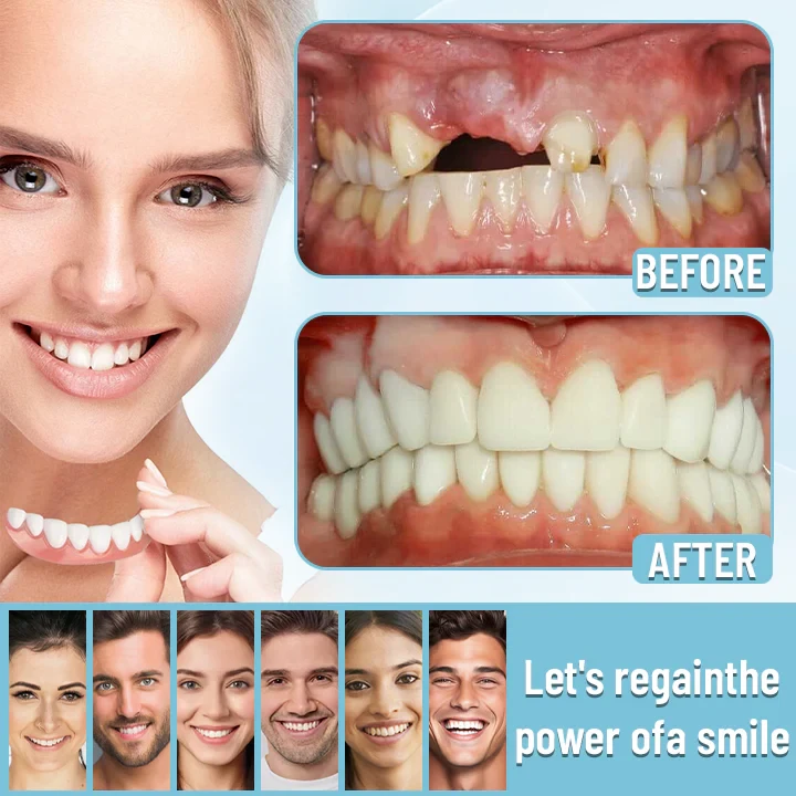 Bikenda Official StoreAdvanced Full Denture Set