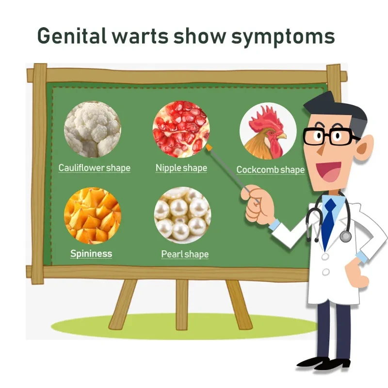 Pinghouyou Wart Remover Cream