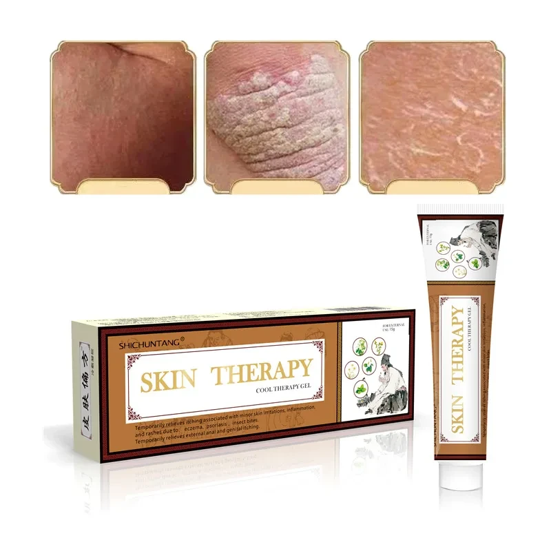 Psoriasis Cream Skin Care Lotion for External Use 15g Herbal Cream