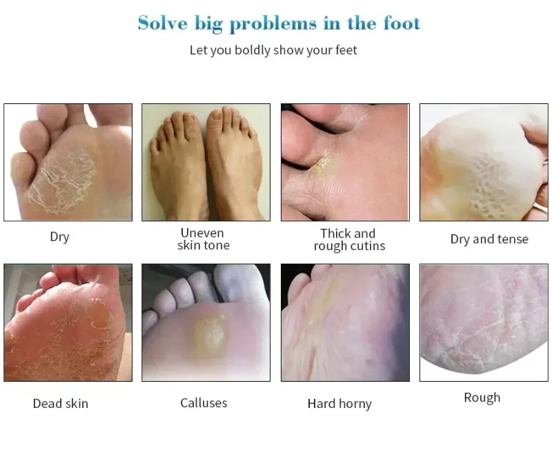 Exfoliating Foot Mask Foot SPA Pedicure Socks Removing Dead Skin Whitening Heels Feet Peeling Anti Cracked Foot Skin Care
